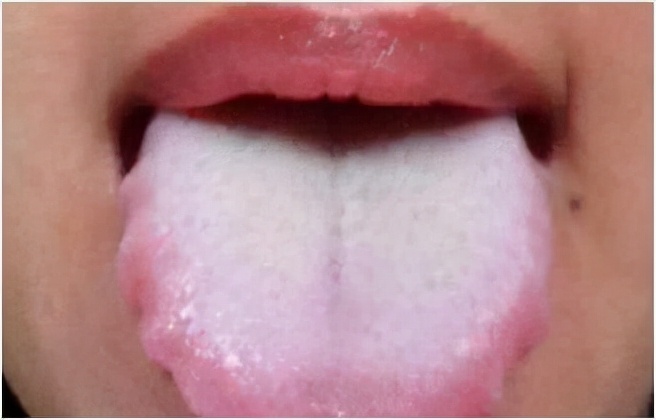 孩子鼻炎腺样体肥大中医怎样调理,常见五种鼻炎的治疗