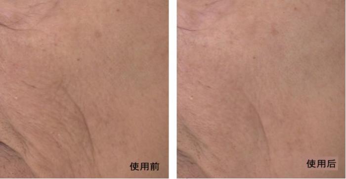 四川肽美,四川肽美生物科技有限公司怎么样