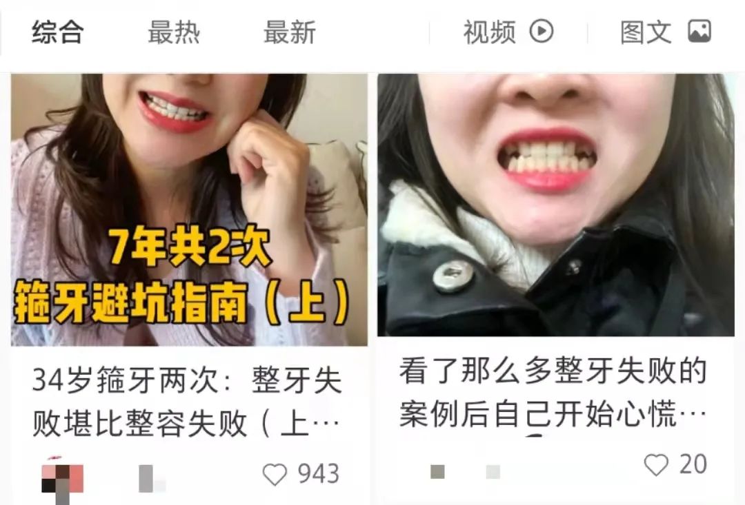 第一批整牙的人现在怎么样了,第一批整牙的人