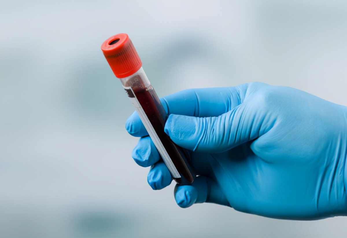 肾病尿毒症腿肿怎么办,男子拒绝体检双脚肿胀查出尿毒症