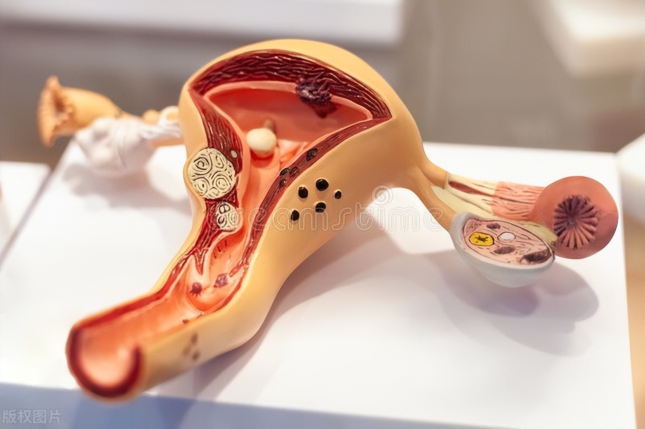 卵巢早衰能逆转吗？医生：出现5个症状，或是身体发出预警信号