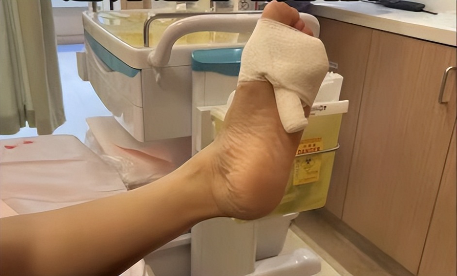 前央视主持突发意外！脚被这种金属条穿透鲜血直流！很多家里装了