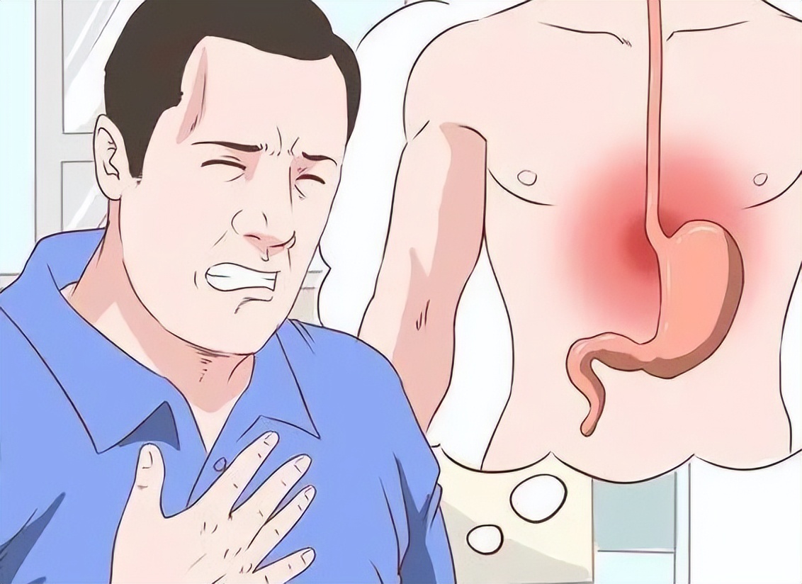 5元和50元的奥美拉唑,95块的奥美拉唑