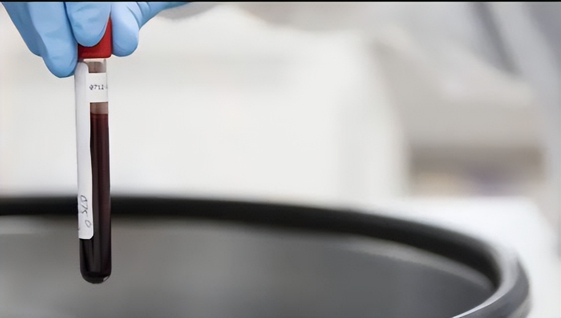 香港查获1500血液样本,疑与“寄血验子”有关,内地人为何要验子