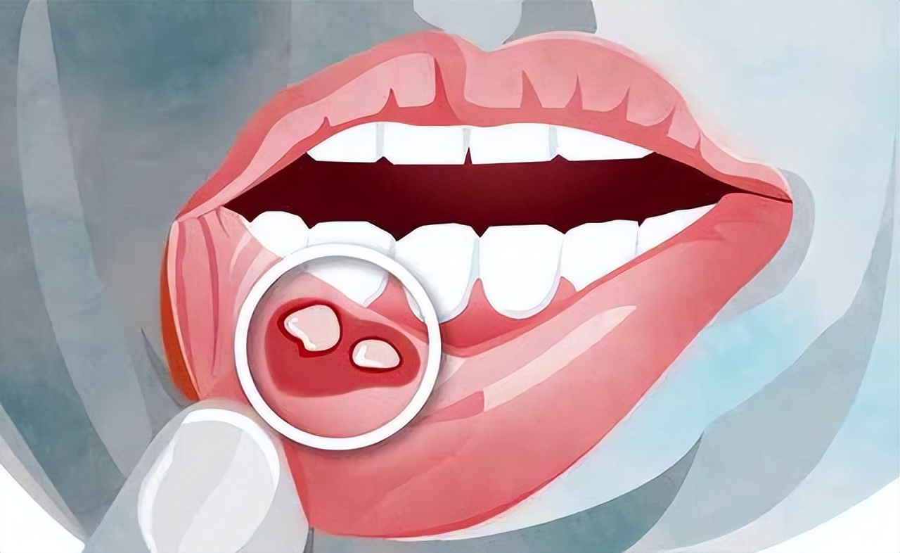 葡萄不宜哪类人吃,葡萄不能吃得太多吗