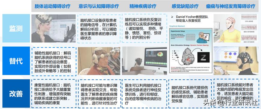 脑机接口发展现状及展望,脑机接口公司靠什么盈利