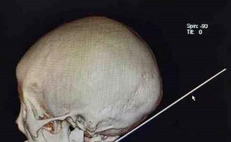 11岁男孩因写作业和父母吵架,因写作业与家长争执