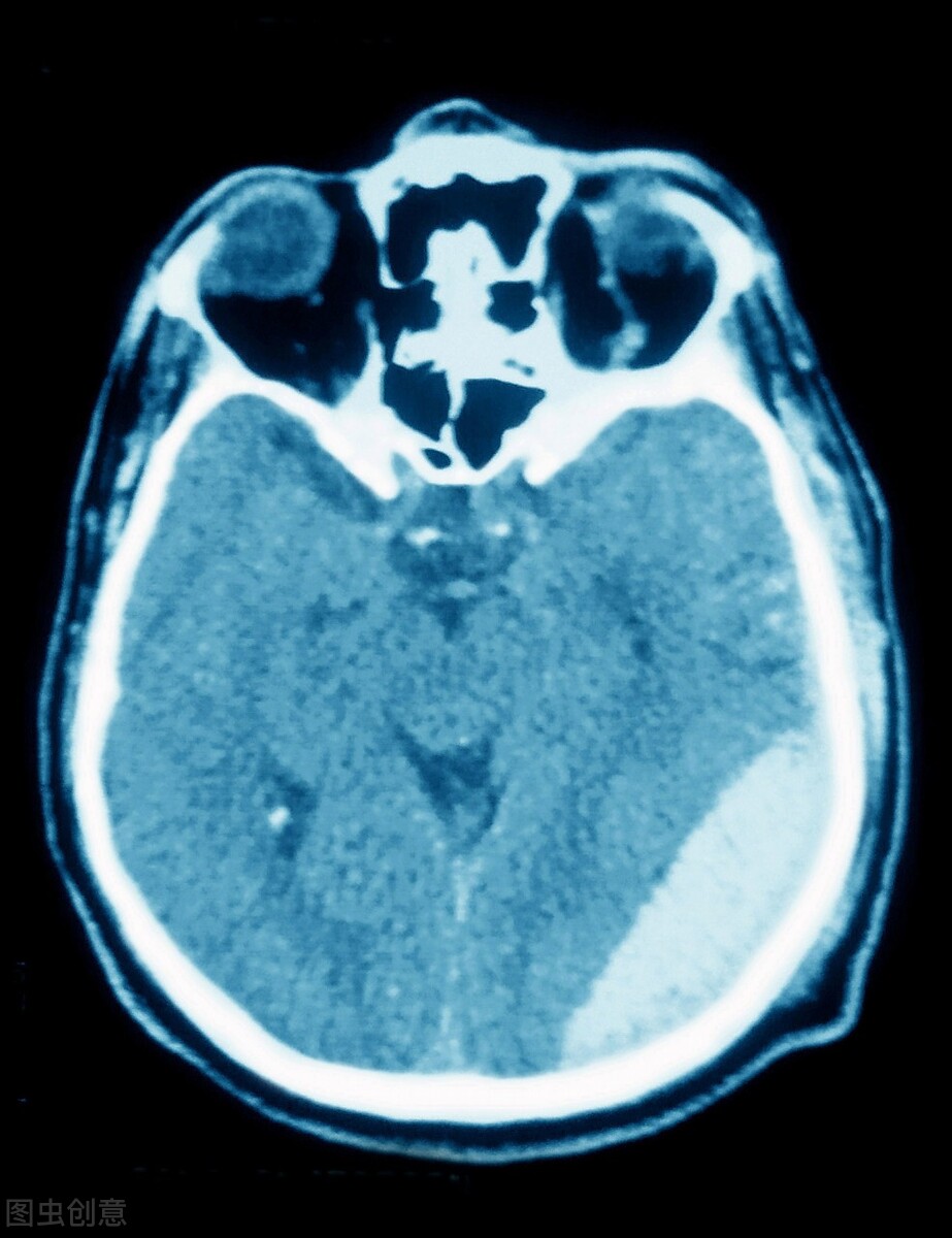 严重脑外伤急诊处理流程,头部受伤生命体征消失怎么抢救