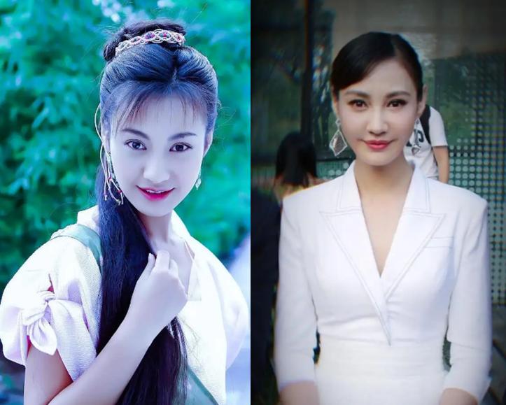 最近脸僵硬的女星,脸部变僵硬的女明星