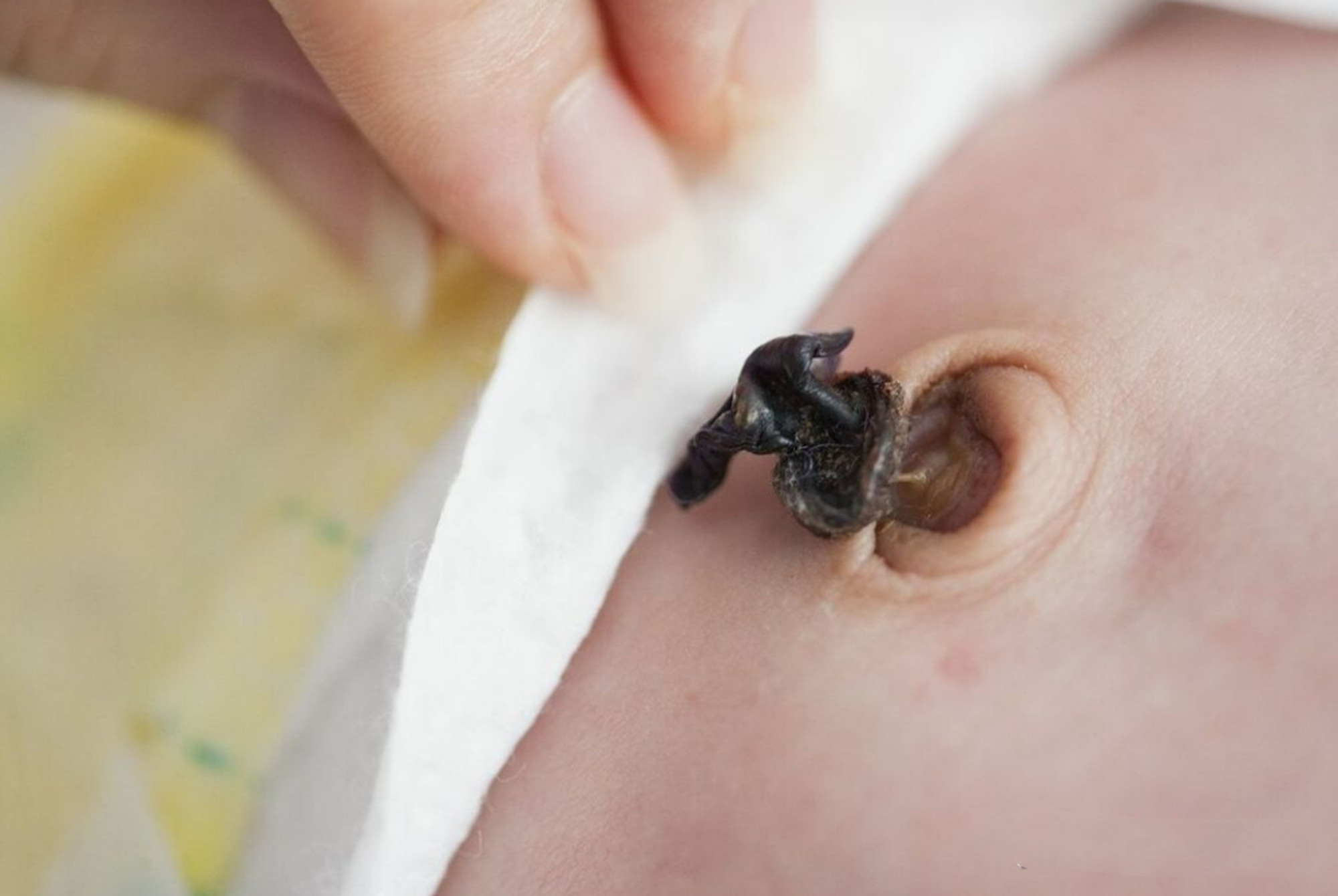 八个月宝宝肚脐眼黑泥怎么清理,宝宝肚脐眼黑黑的泥巴要清洗吗