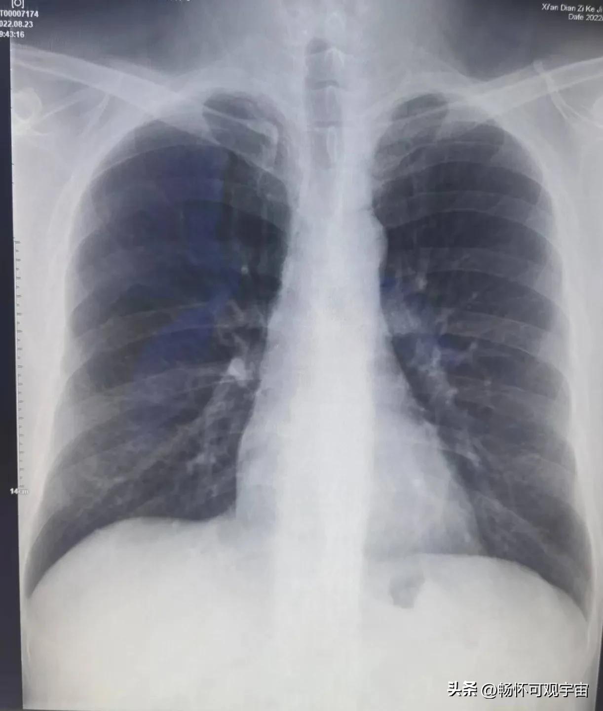 同志们，如此按摩有风险啊