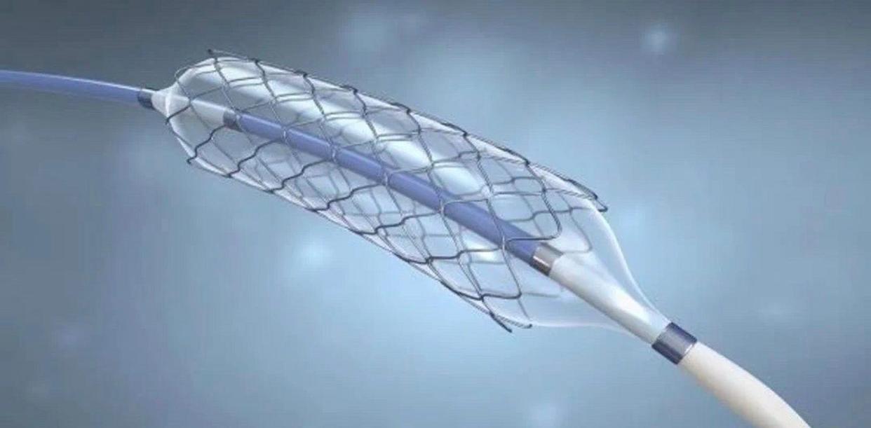 装心脏支架利大还是弊大,逐渐停止安装心脏支架