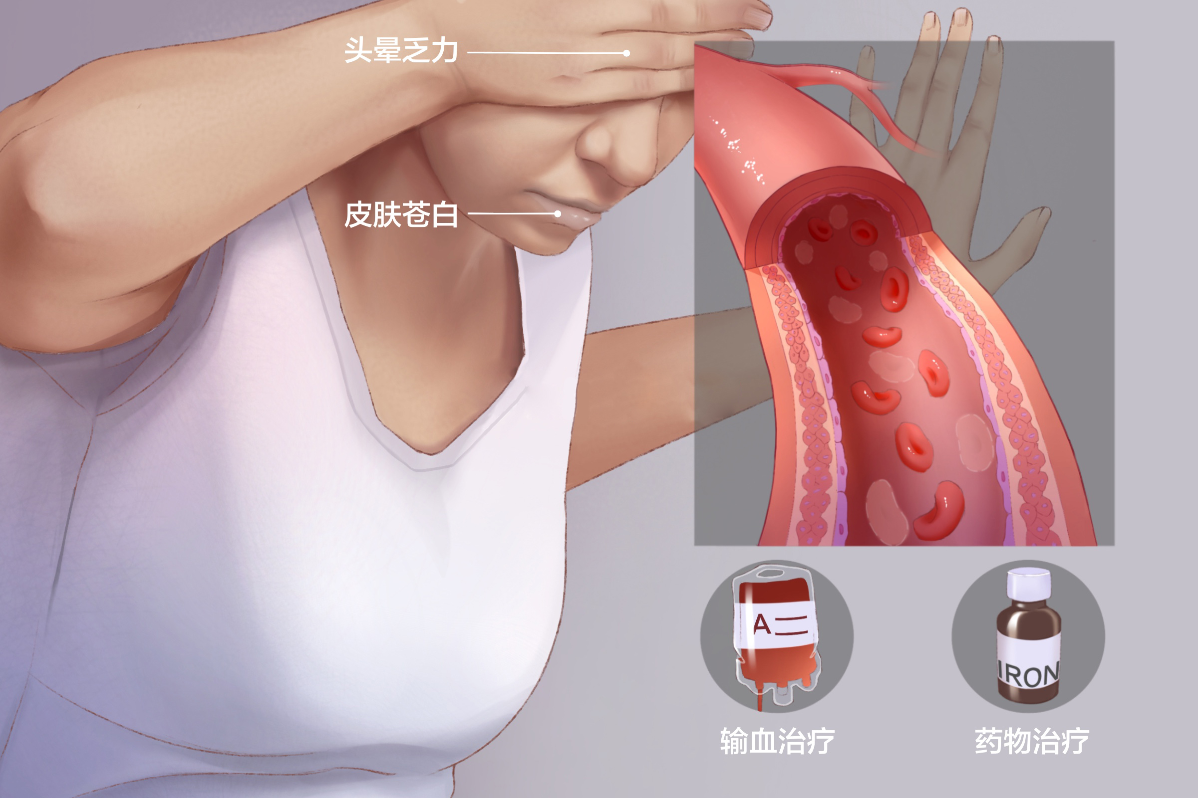 mds白血病如何让骨髓恢复正常,治疗mds转急性髓系白血病多少钱