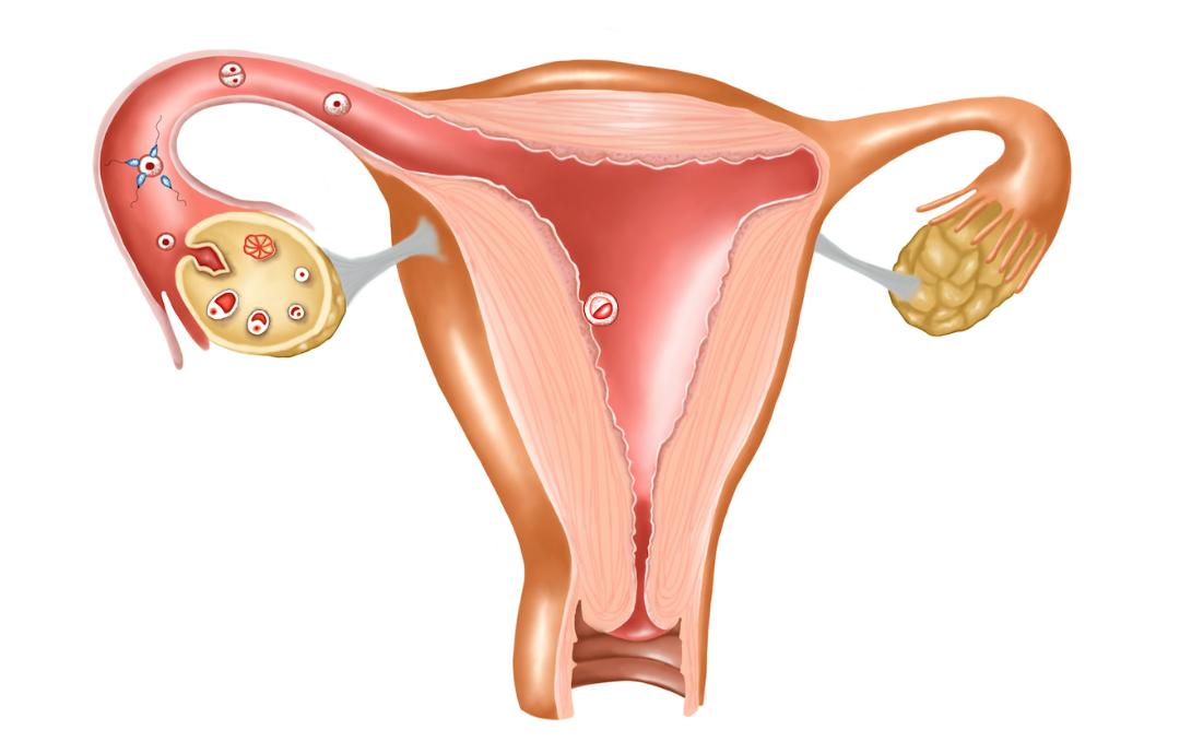 24岁姑娘丧失生育能力,24岁女孩失去了生育