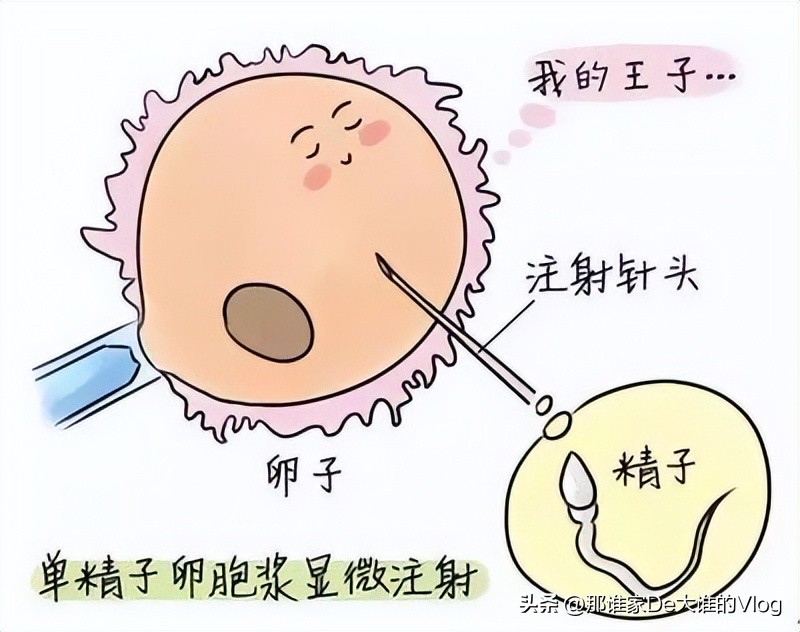精子和卵子生成的全过程,取出的卵子和精子体外培育过程