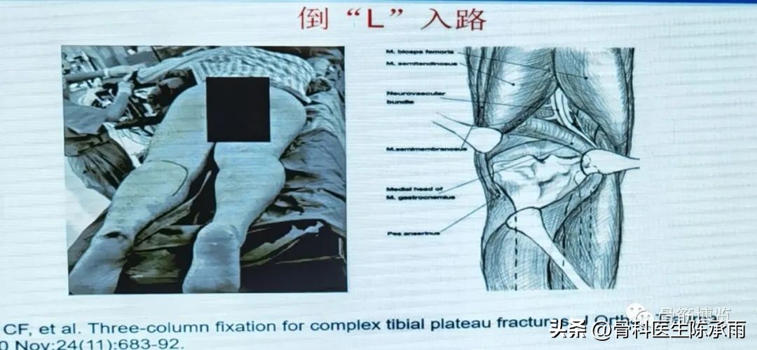 国家卫健委主办的骨创伤专项能力培训项目----下肢损伤学习班