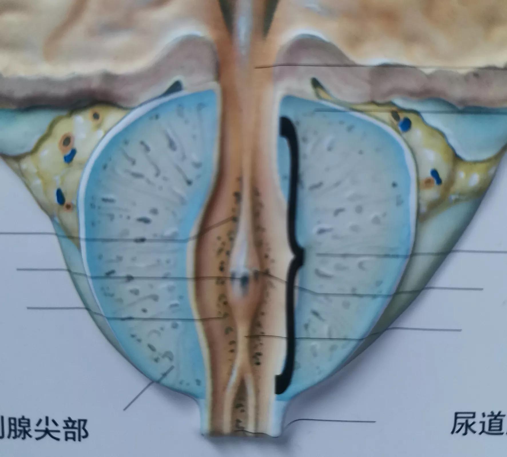 慢性非细菌性前列腺炎影响生育吗,慢性非细菌性前列腺炎小便有泡沫