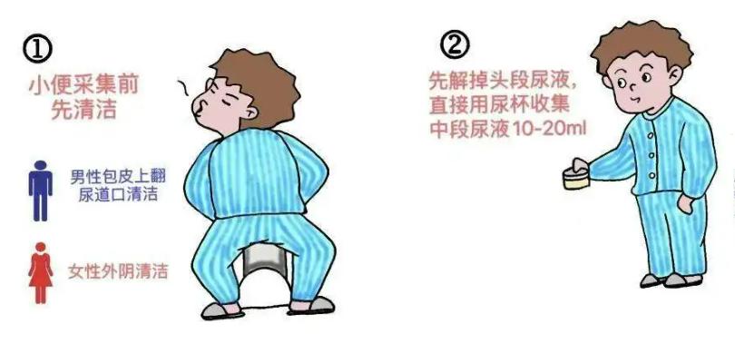 尿标本为何是晨尿,什么时段的尿液标本检查更准确