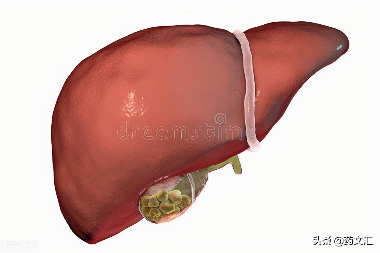 肝胆湿热经方治疗胆结石,胆结石湿热肝郁怎么治