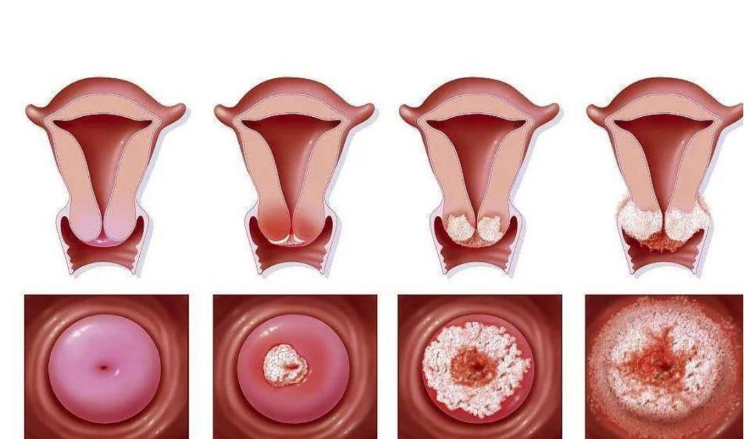 *生活性**后流血，都是爱人的错？