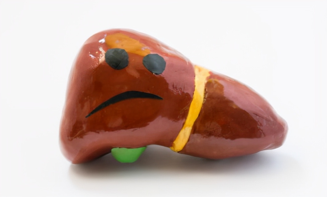 大蒜是肝病的“发物”？医生提醒：若想养肝，这4种食物尽量少吃