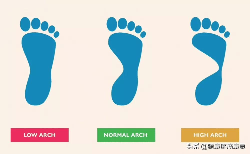 功能性高足弓的练习方式,用什么方法舒缓足弓疼痛