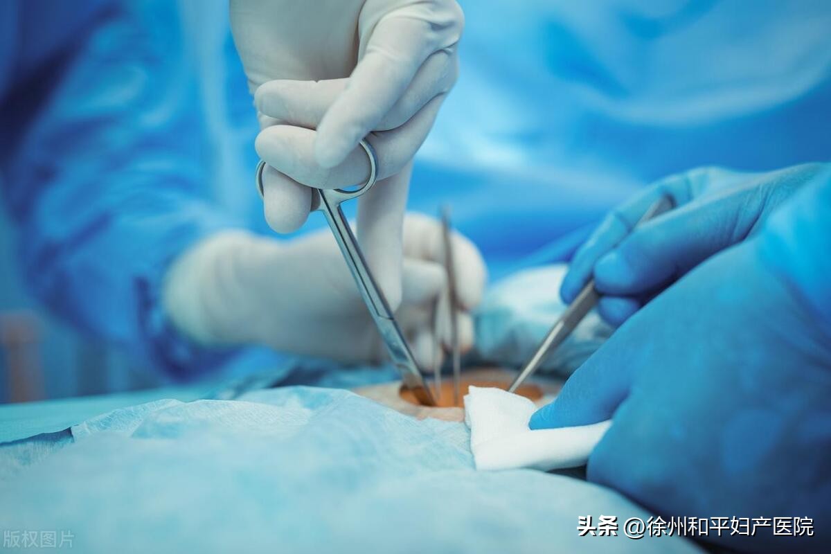 老婆结扎10年还可以生小孩吗,结扎9年后意外怀孕怎么办