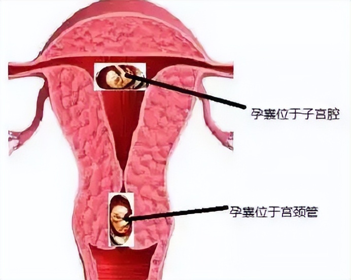 沈阳红十字会医院妇科医生,沈阳红十字会医院妇产科