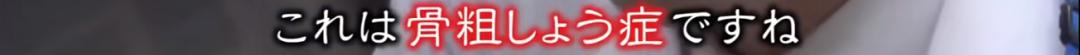 日本漂亮小姐姐不想被晒黑，每天全副武装！2年后身高竟缩水7cm…