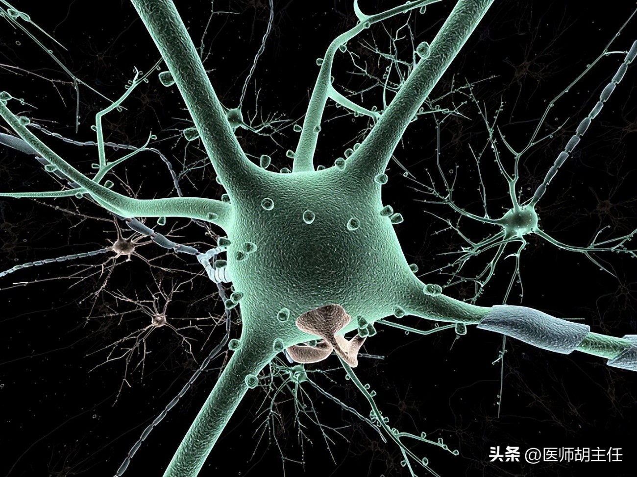 带状疱疹缠腰蛇为什么会头痛,蛇缠腰带状疱疹怎么才算治好