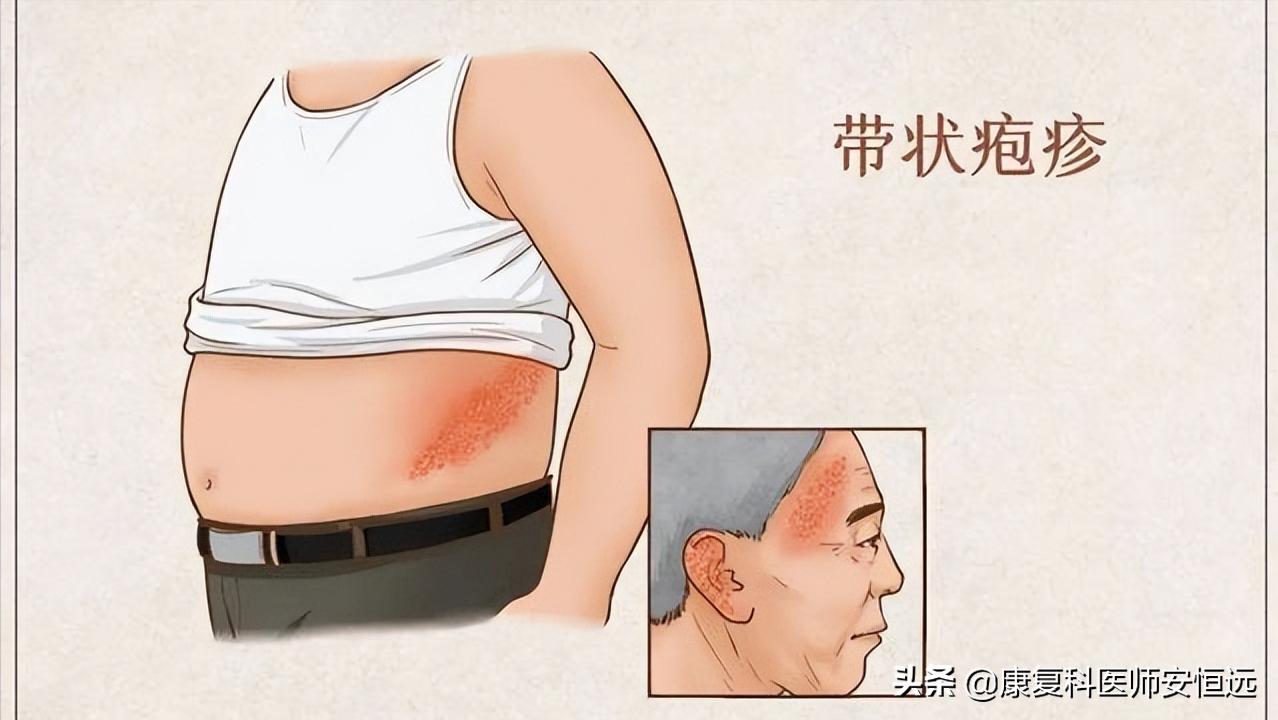 世上最疼的病是什么病？临床上这3种“疼痛”，经历过的都是超人