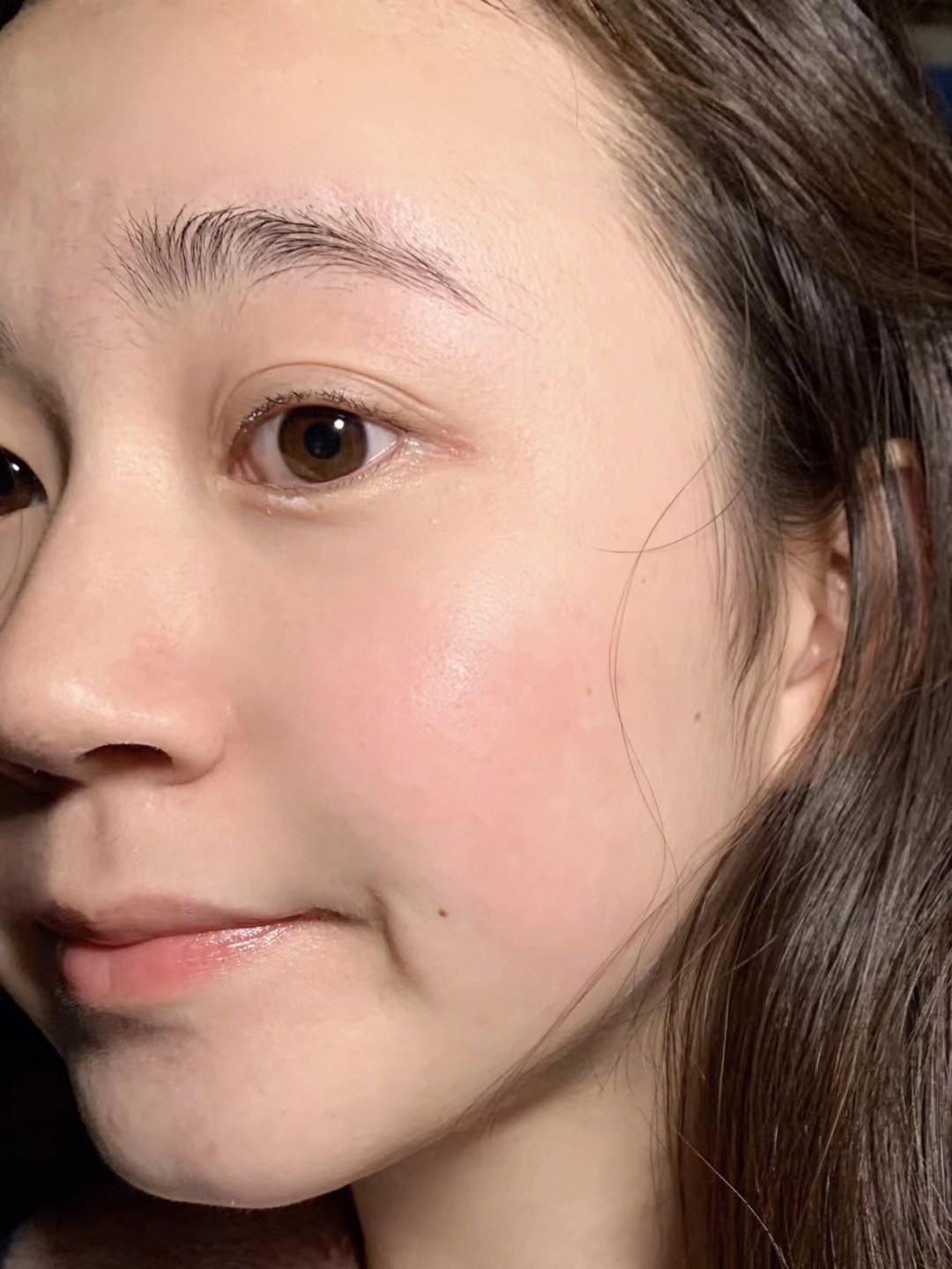 毛孔粗大是什么原因应该怎样改善,毛孔粗大的原因及改善方法