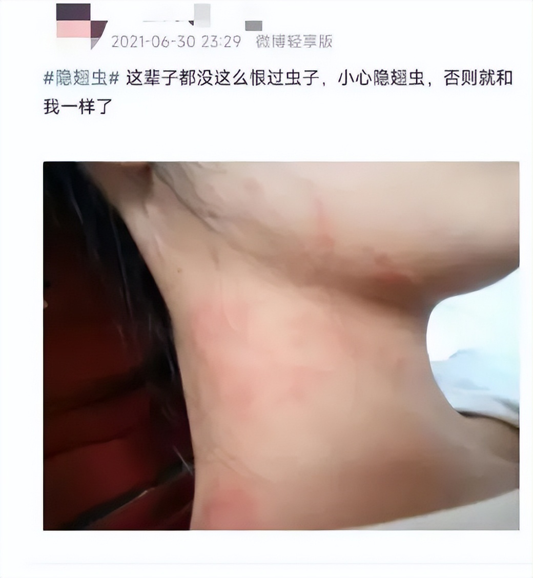 千万不要用手拍的几种虫子,碰到这些虫子千万不要去碰