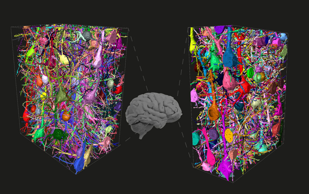 独一无二的人类？平静大脑中的网络