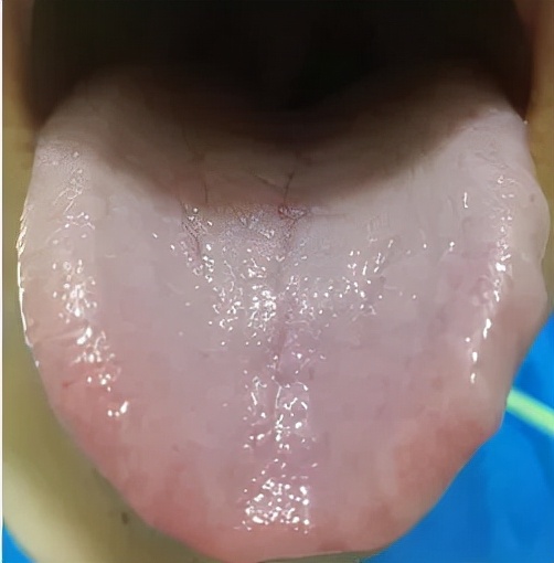 气血不足皮肤暗黄怎么调养,男士肝郁气血不足怎么调养