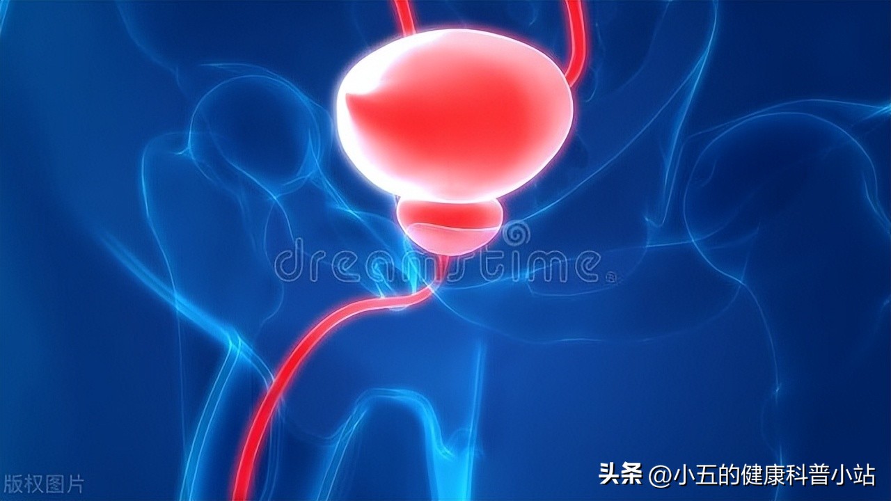 清热解毒，利湿通淋，谈谈治疗慢性前列腺炎的中成药—宁泌泰胶囊