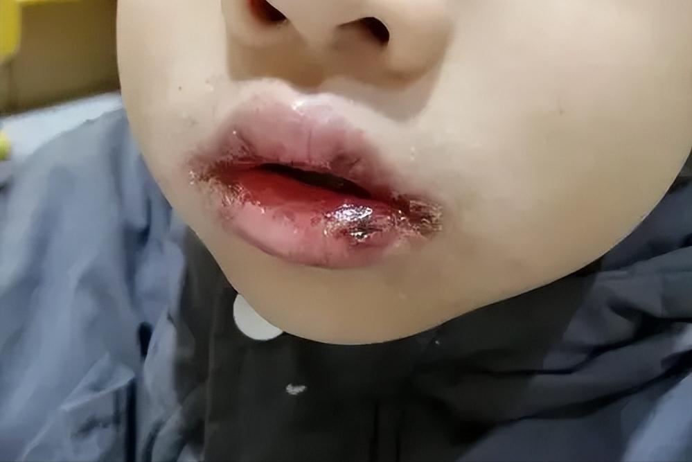 几块钱一瓶的维生素b2好用吗,维生素b2几块钱的能用吗