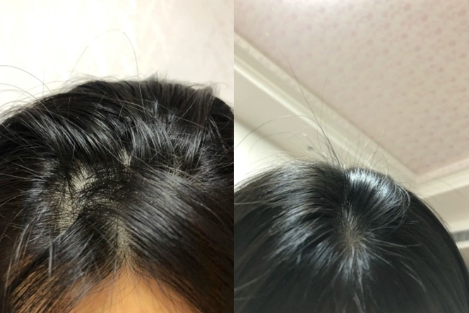 毛躁头发孕妇洗发水推荐,孕妇能用的去屑洗发水推荐