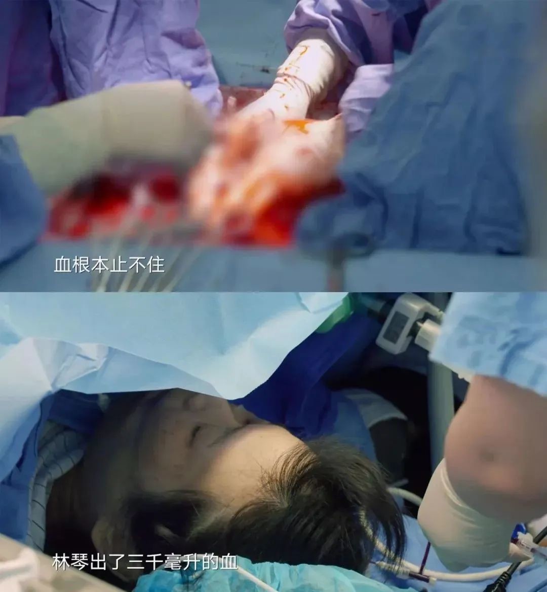 经历26次胎停,经历26次流产37岁怀孕成功