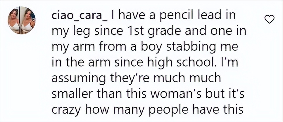 美国女子被橡皮子弹击中,女子手术取出戳20年铅笔芯