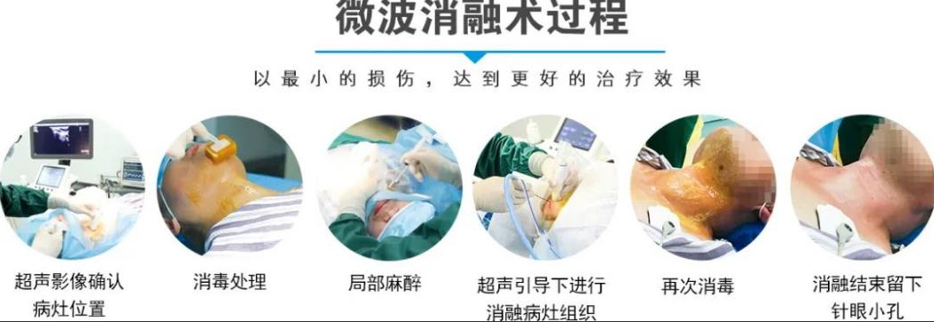 甲状腺结节往下移了可以做消融吗,甲状腺结节恶变了严重吗