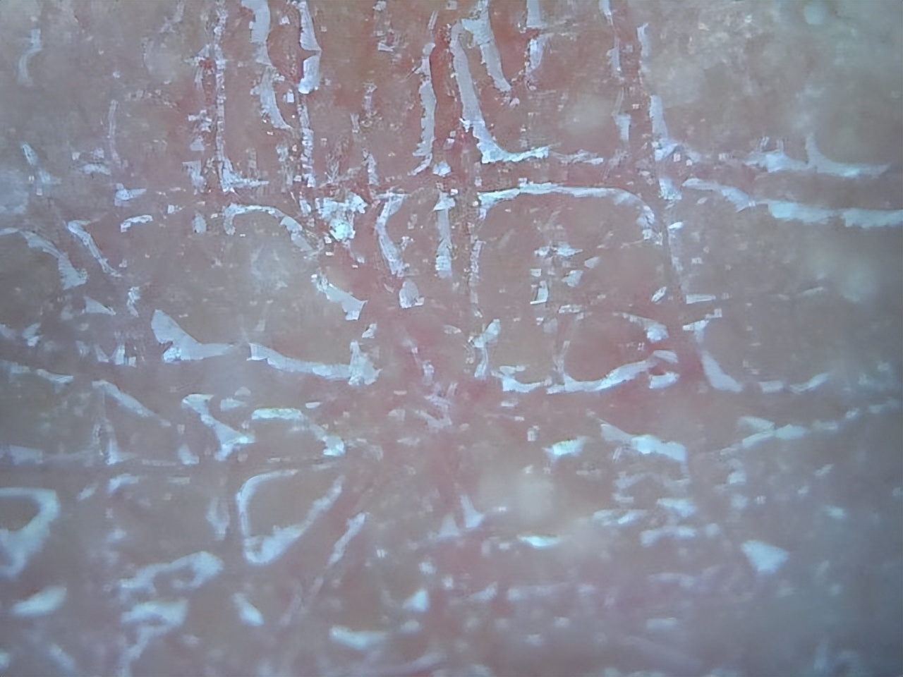 皮肤洗不干净老是脱皮,不洗澡身上晒得脱皮了怎么办