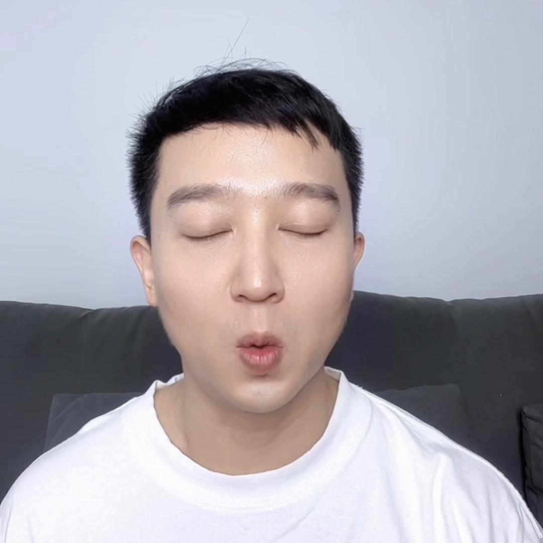 遗传秃头一般什么时候秃,秃头是遗传怎么治疗