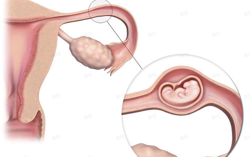 没有子宫的女性，还可以“办事”吗？医生的这些话，希望你听进去