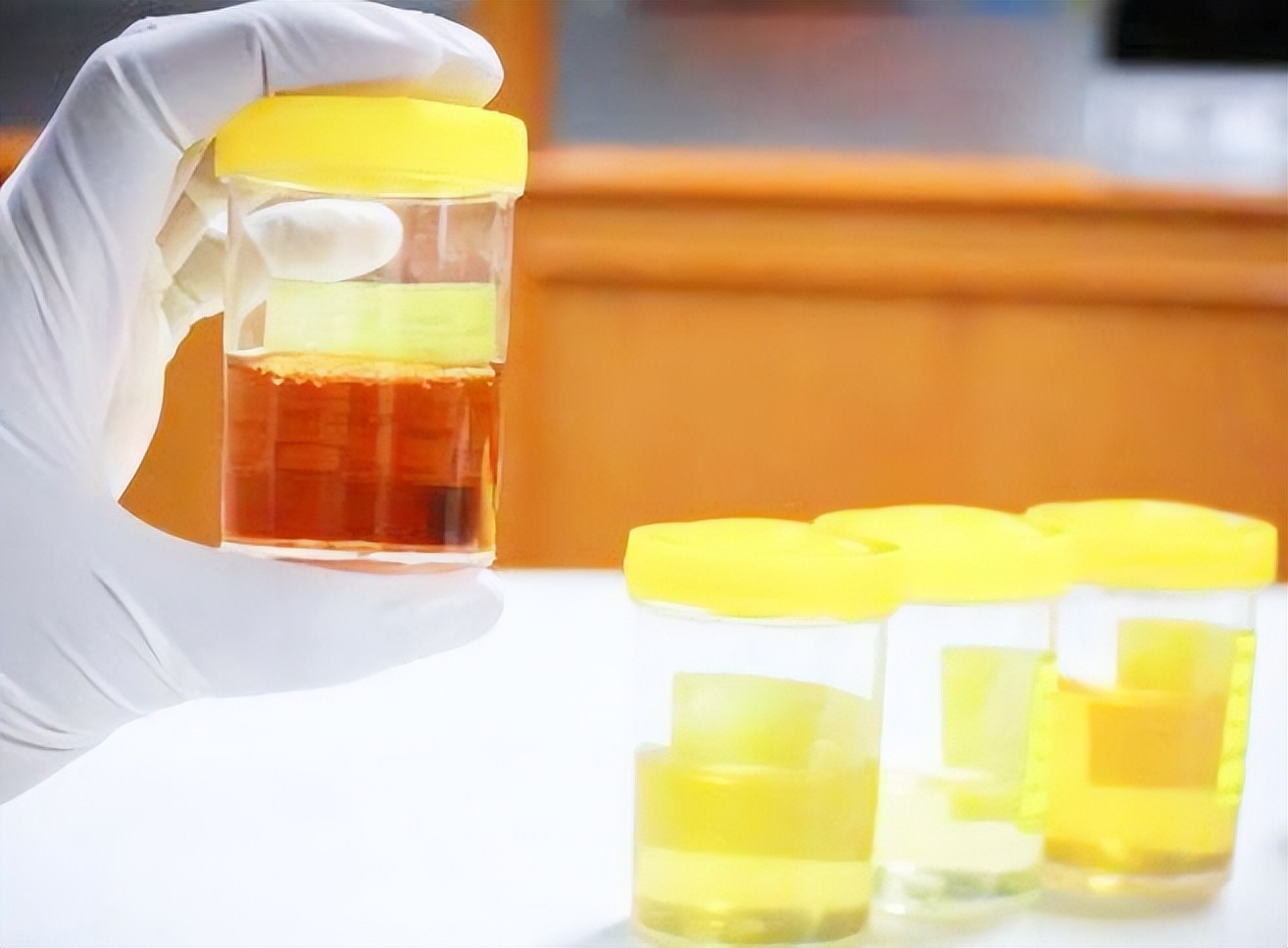 寿命长短看小便,排尿时有哪四种情况会判断寿命