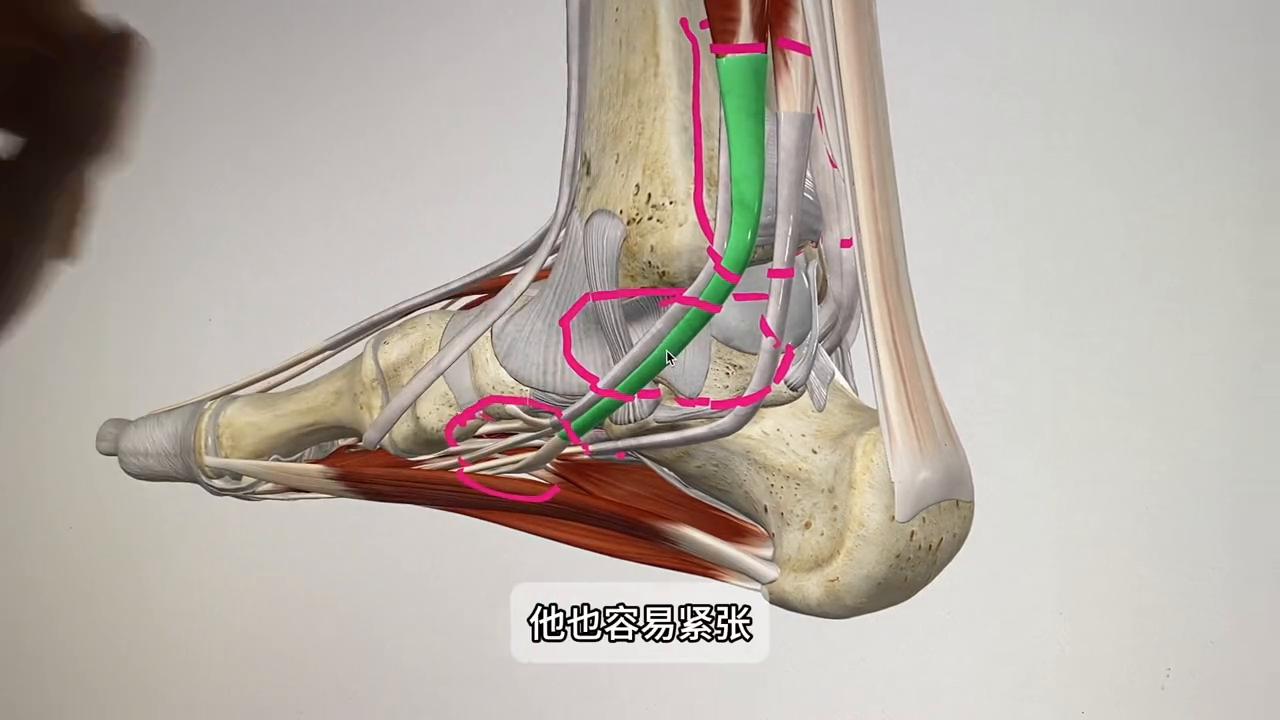 小腿脚踝内侧疼怎么回事,跑步后小腿内侧脚踝疼