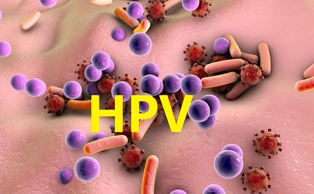 外阴癌有什么先兆,外阴癌会有怎样的症状