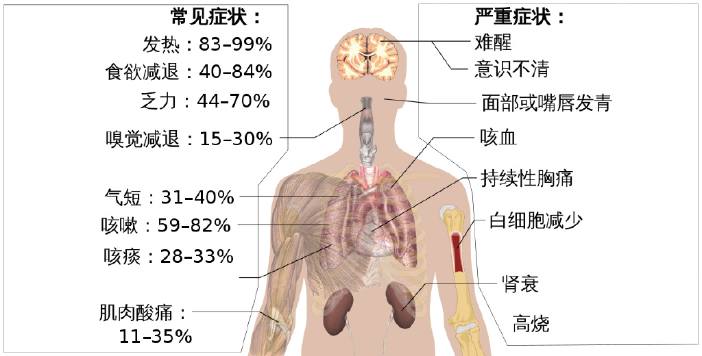 连花清瘟医药龙头股,连花清瘟的产业链上市公司