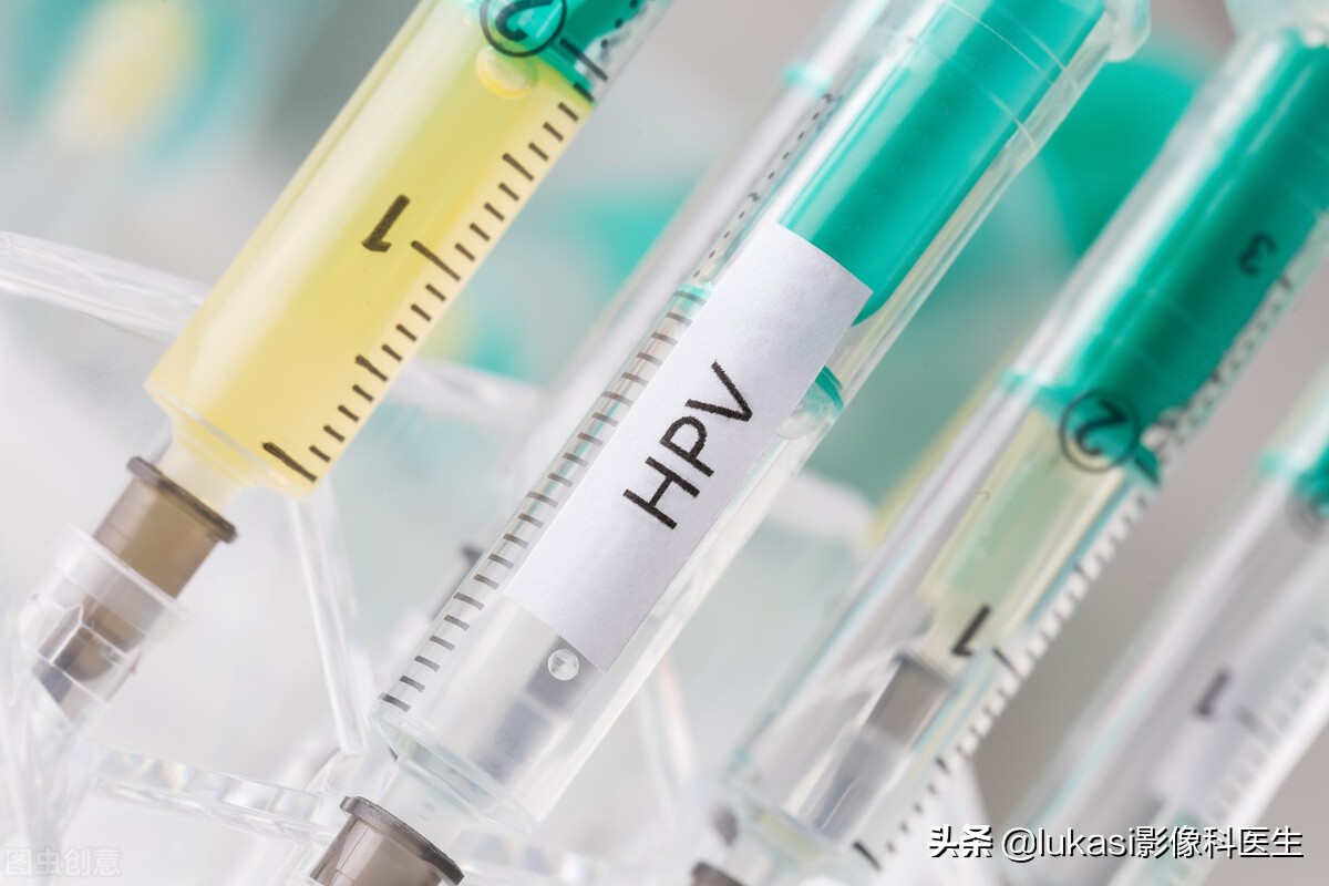 宫颈癌的可怕之处,宫颈癌日益年轻化加强筛查是重点