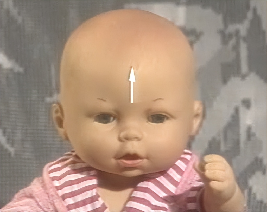 发热穴位小儿推拿,发热的小儿推拿退烧手法